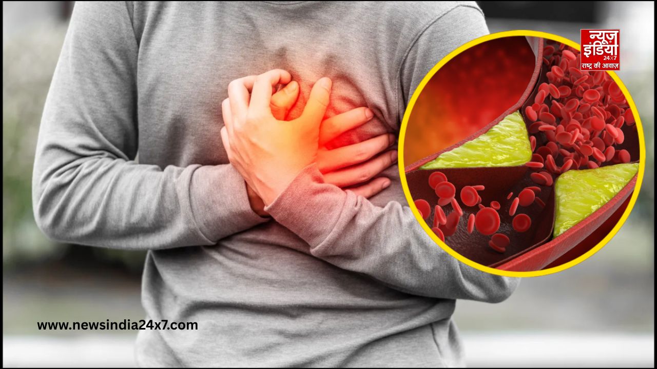 Cholesterol