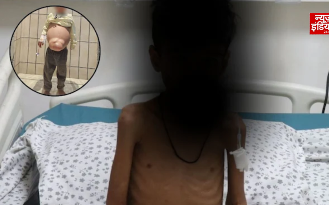 3 साल तक दस्त और शरीर में सूजन से जूझता रहा 5 साल का बच्चा, जेनेटिक टेस्ट से खुली बीमारी की गुत्थी