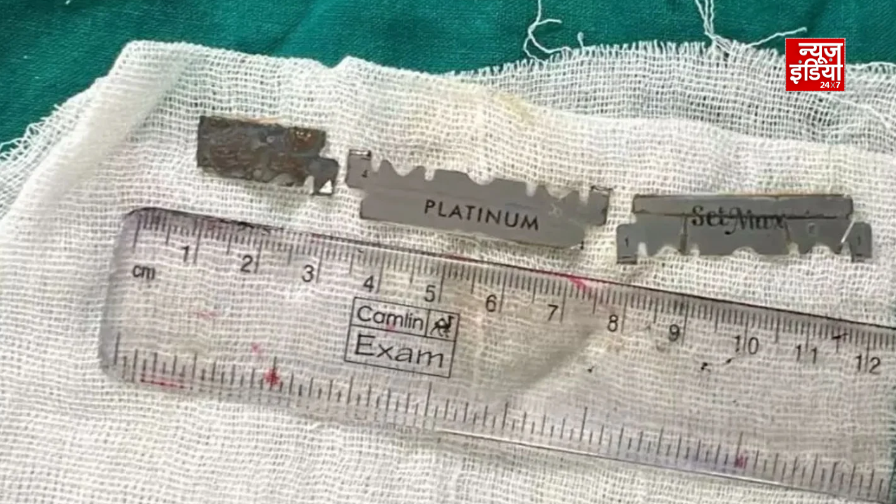 Lavanyaphto (4) 16 साल के किशोर के पेट से एंडोस्कोपी के जरिए निकाले गए रेजर ब्लेड के टुकड़े